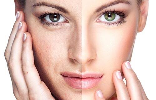 Before and After Result